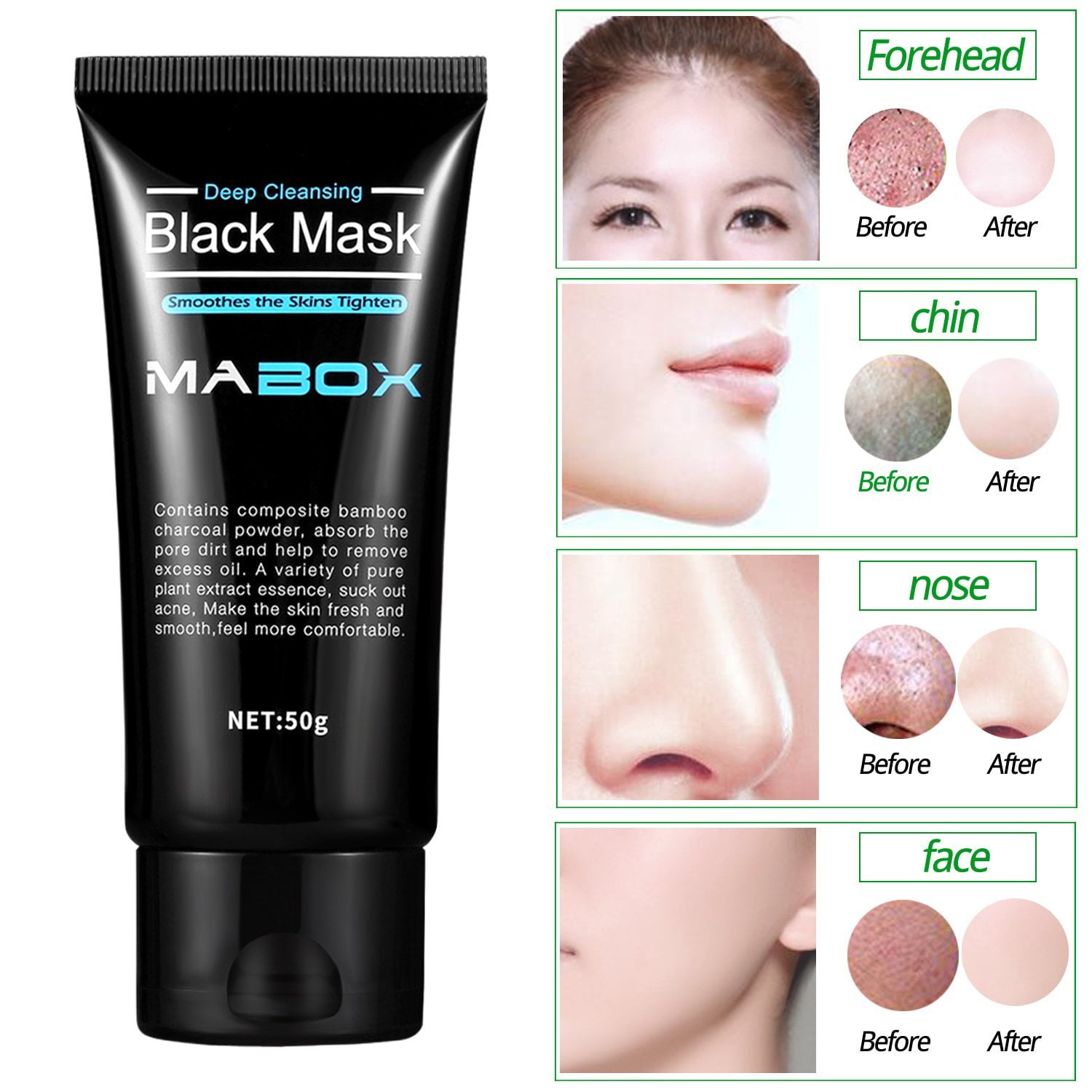 Beauty Could these marvel products banish blackheads
