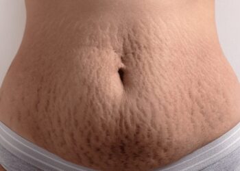 Maximizing Athletic Performance with Mark Stretcher